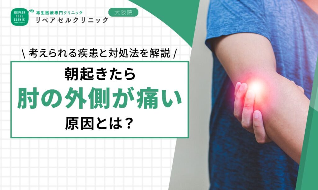 朝起きたら肘の外側が痛い原因とは？考えられる疾患と対処法を解説