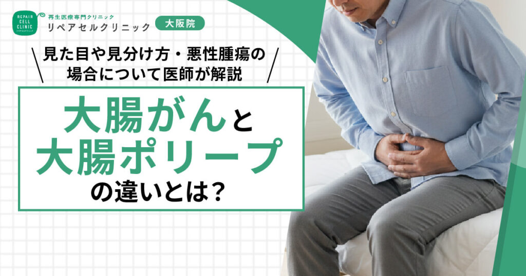 大腸がんと大腸ポリープの違いとは？見た目や見分け方・悪性腫瘍の場合について医師が解説