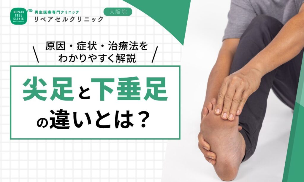 尖足と下垂足の違いとは?原因・症状・治療法をわかりやすく解説