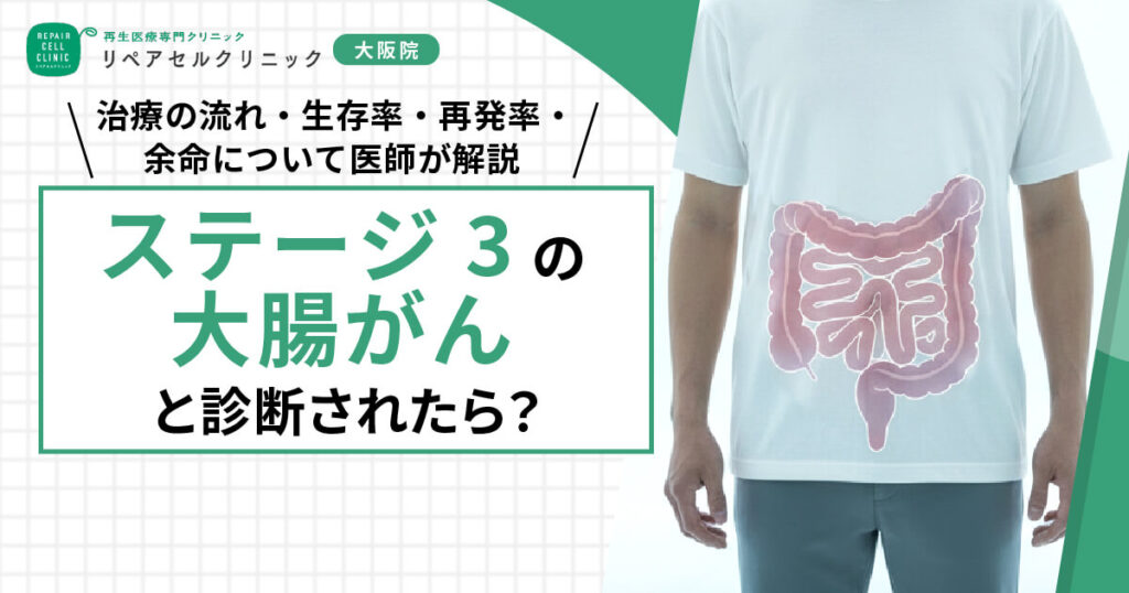 ステージ3の大腸がんと診断されたら?治療の流れ・生存率・再発率・余命について医師が解説