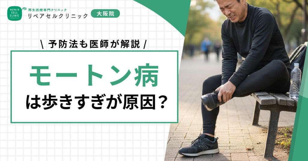 モートン病は歩きすぎが原因?予防法も医師が解説