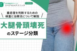 大腿骨頭壊死のステージ分類|重症度を判断するための検査と治療法について解説