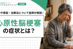 心原性脳梗塞の症状とは？特徴や原因・治療法について医師が解説