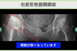 東京院-1013 症例画像