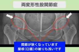 東京院-1041 症例画像