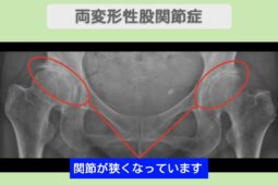 東京院-938 症例画像