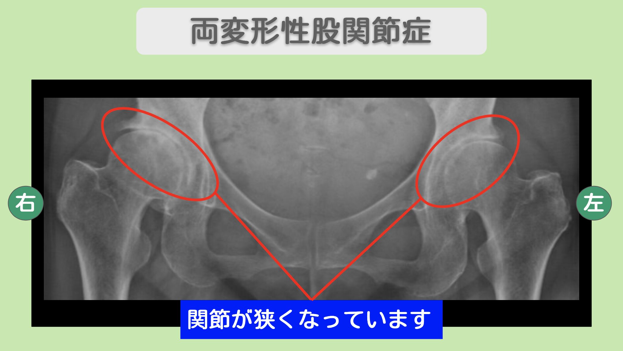 東京院-938 症例画像
