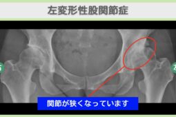 東京院-970 症例画像