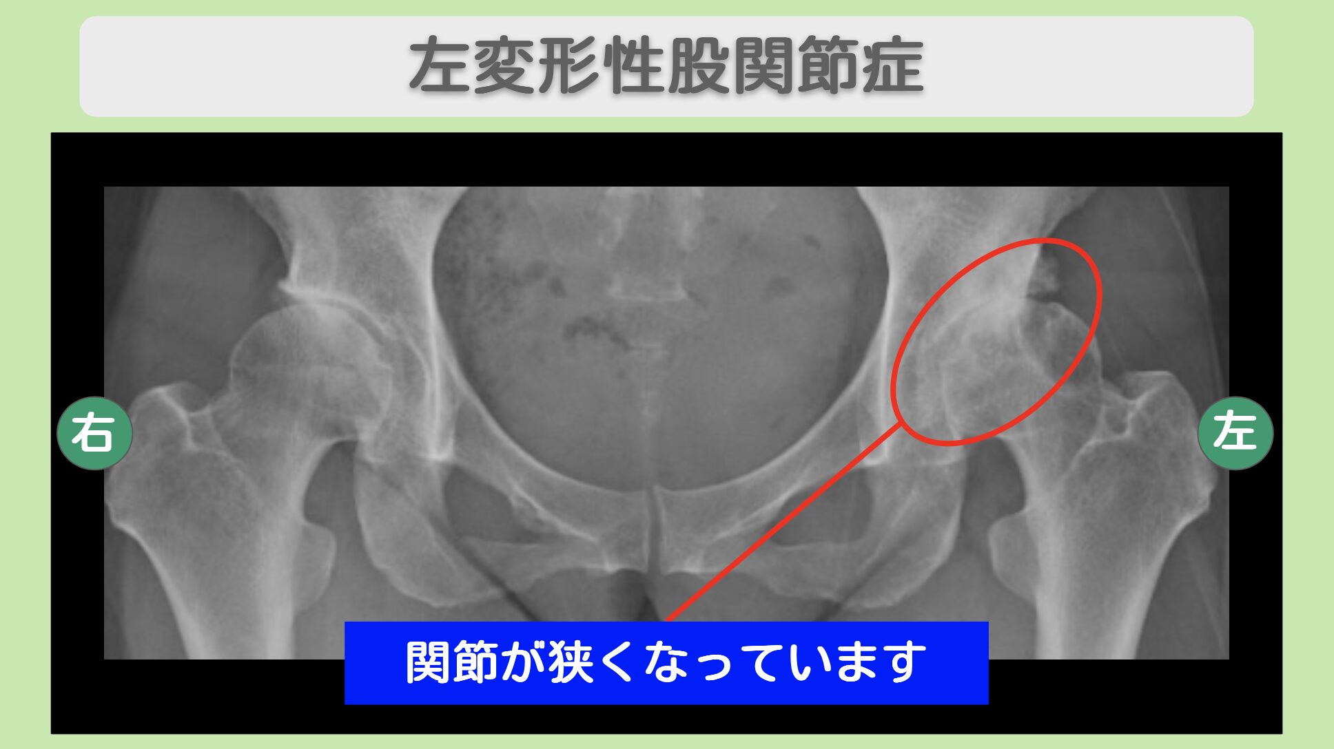 東京院-970 症例画像