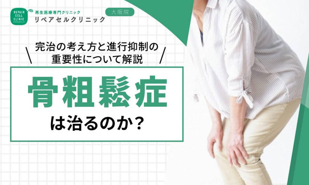 骨粗鬆症は治るのか？完治の考え方と進行抑制の重要性について解説【医師監修】