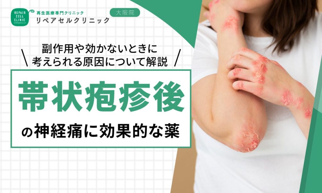 帯状疱疹後神経痛に効果的な薬｜副作用や効かないときに考えられる原因について解説