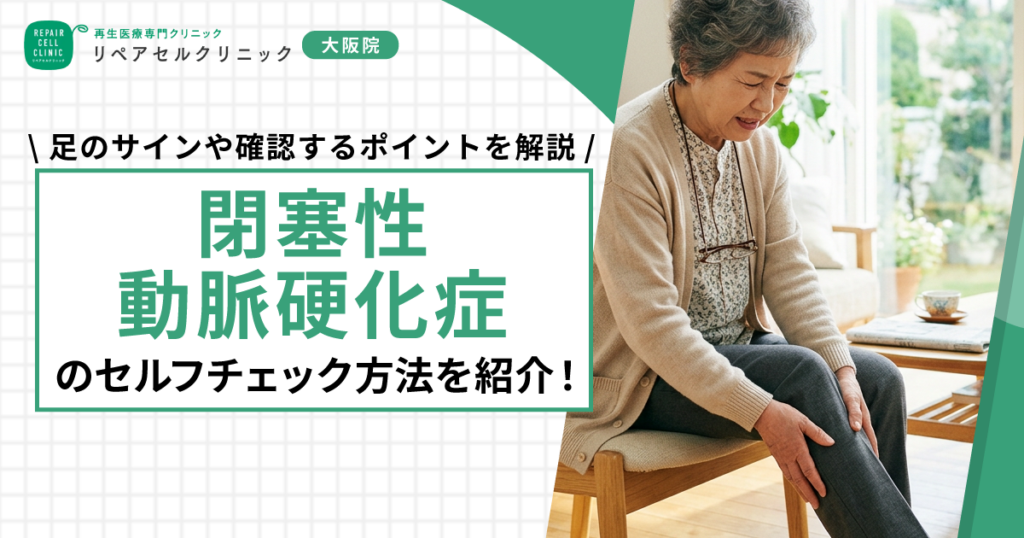 閉塞性動脈硬化症のセルフチェック方法を紹介！足のサインや確認するポイントを解説