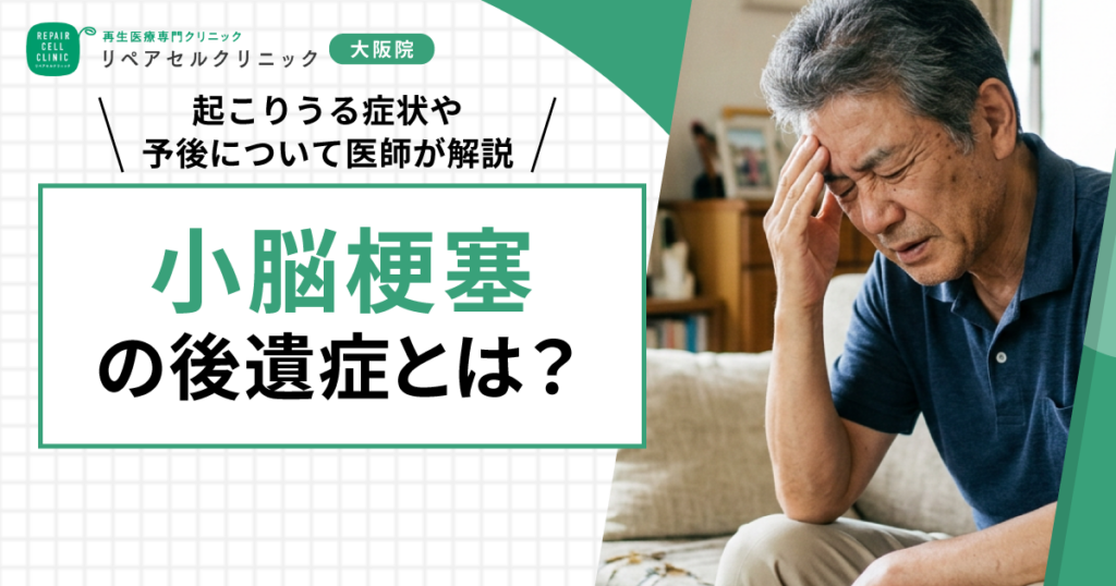 小脳梗塞の後遺症とは？起こりうる症状や予後について医師が解説