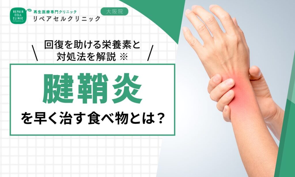 腱鞘炎に効くツボとは？痛みを和らげるセルフケア方法を解説