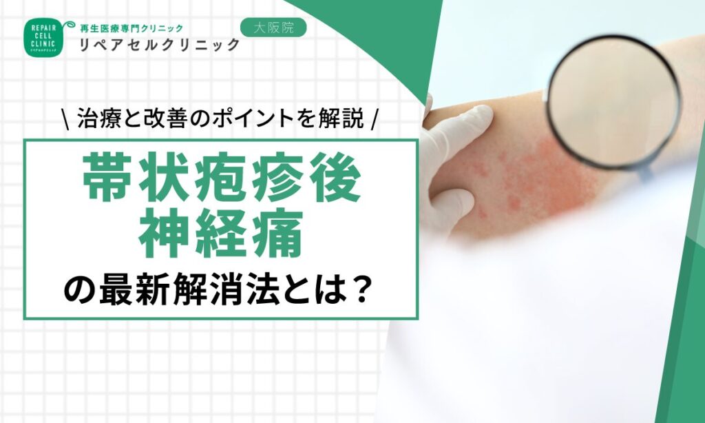 帯状疱疹後神経痛の最新解消法とは？治療と改善のポイントを解説