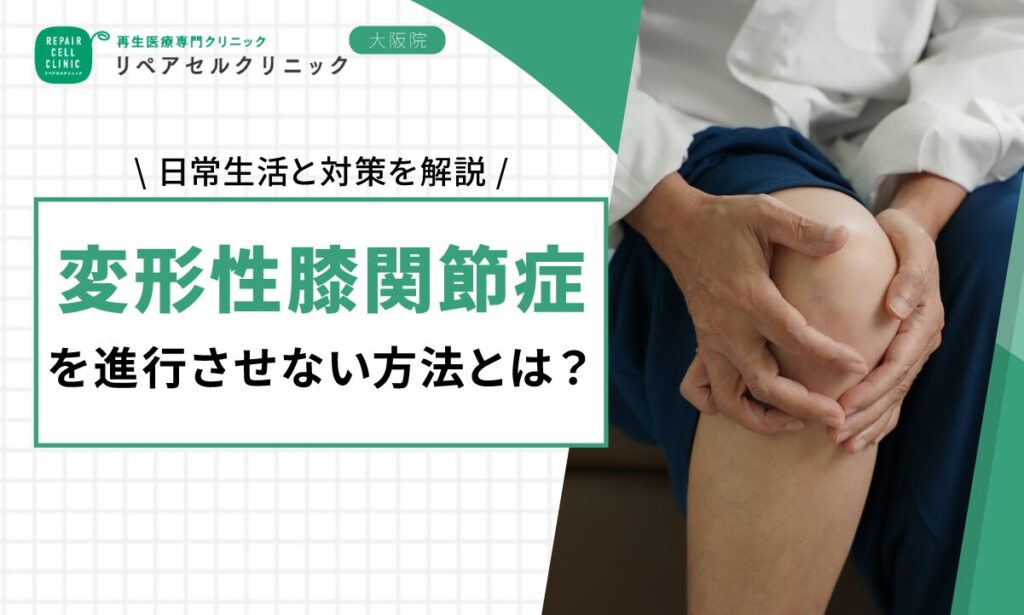 変形性膝関節症を進行させない方法とは？日常生活と対策を解説