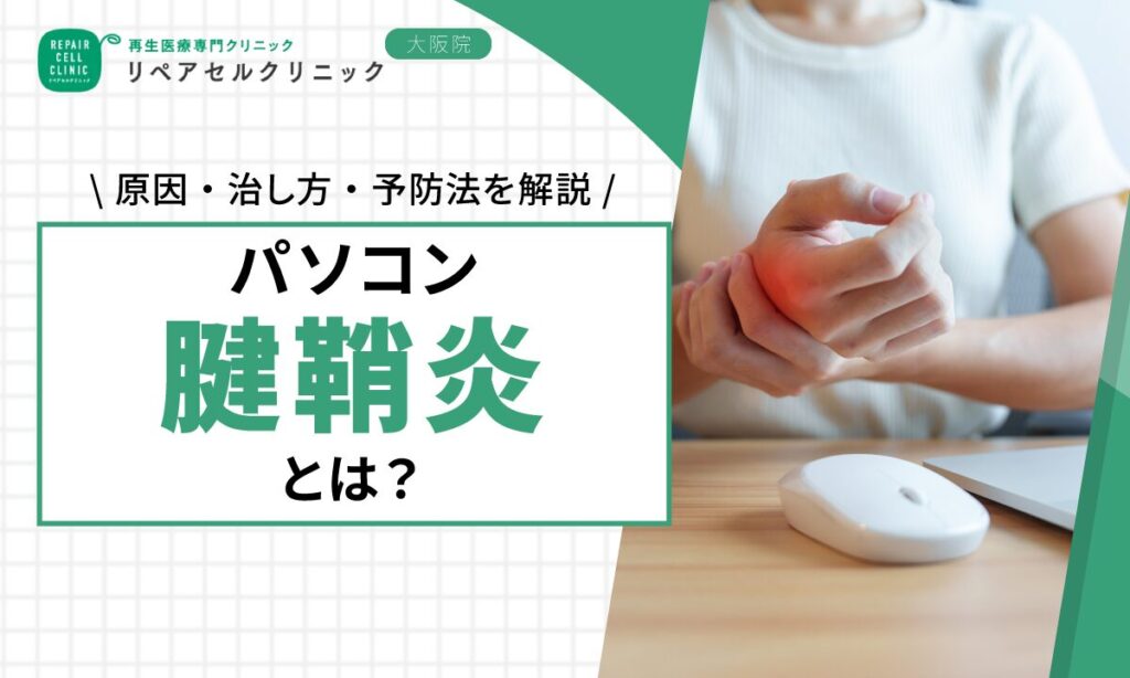 パソコン腱鞘炎とは？原因・治し方・予防法を解説