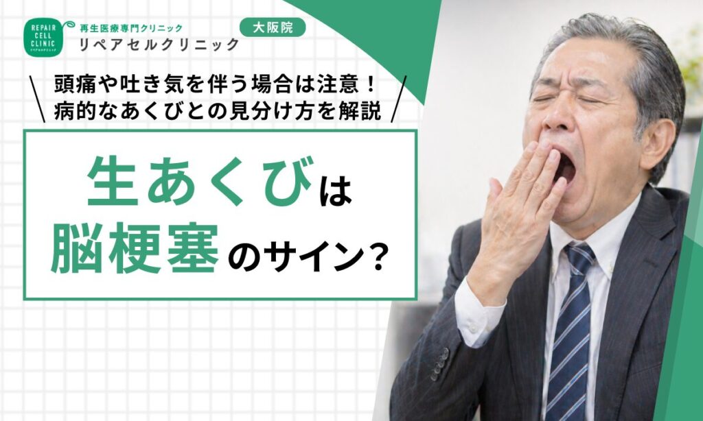 生あくびは脳梗塞のサイン？頭痛や吐き気を伴う場合は注意！病的なあくびとの見分け方を解説