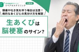生あくびは脳梗塞のサイン？頭痛や吐き気を伴う場合は注意！病的なあくびとの見分け方を解説