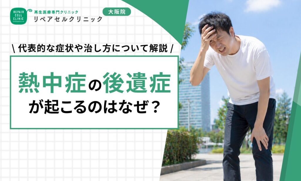 熱中症の後遺症が起こるのはなぜ？代表的な症状や治し方について解説【医師監修】