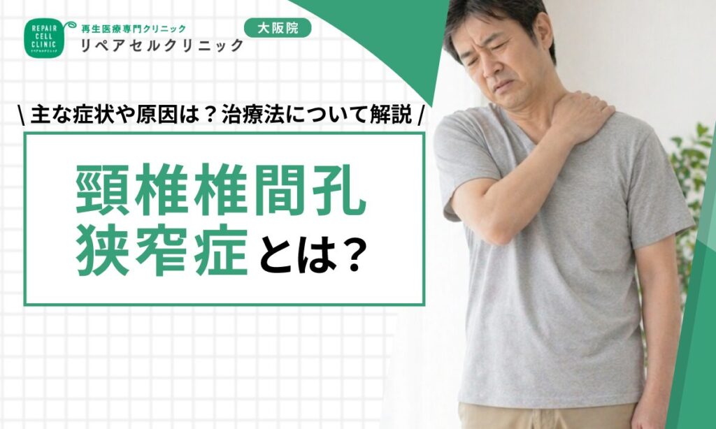 頸椎椎間孔狭窄症とは｜主な症状や原因は？治療法について解説【医師監修】
