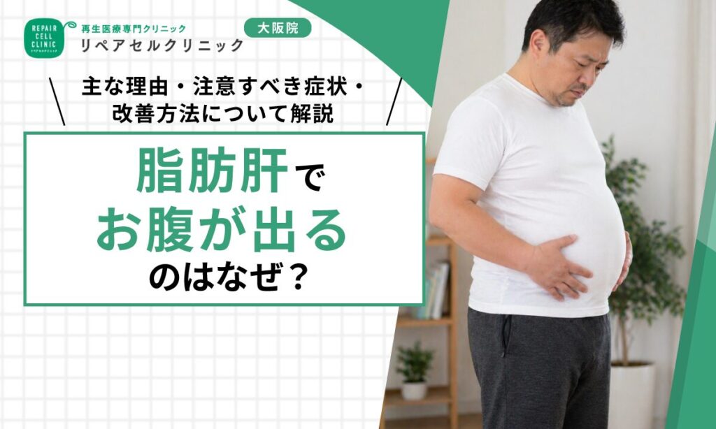 脂肪肝でお腹が出るのはなぜ？主な理由・注意すべき症状・改善方法について解説