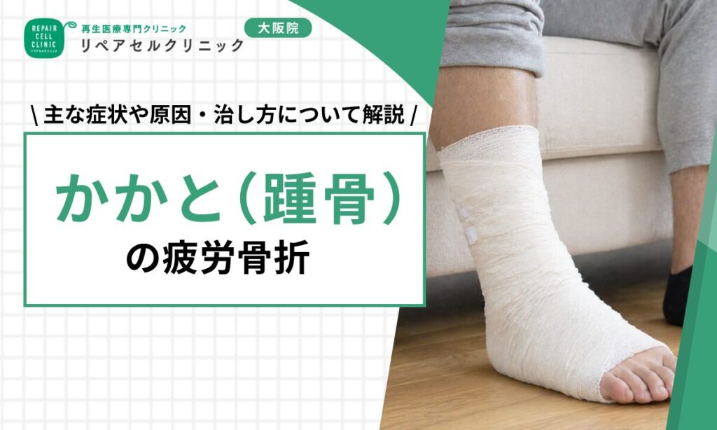 かかと（踵骨）の疲労骨折｜主な症状や原因・治し方について解説