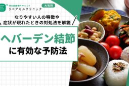 ヘバーデン結節に有効な予防法｜なりやすい人の特徴や症状が現れたときの対処法を解説