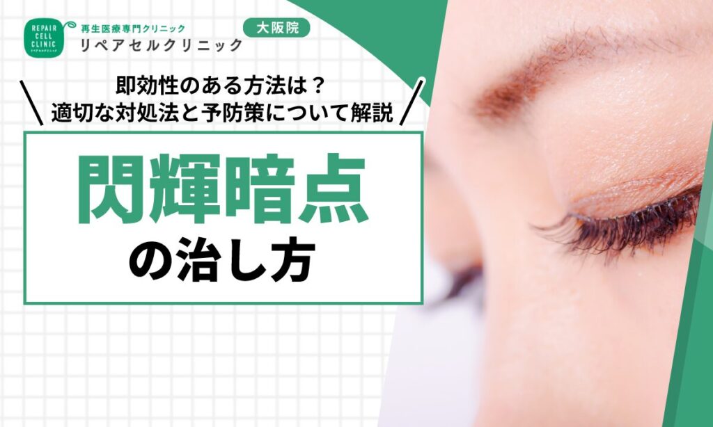 閃輝暗点の治し方｜即効性のある方法は？適切な対処法と予防策について解説