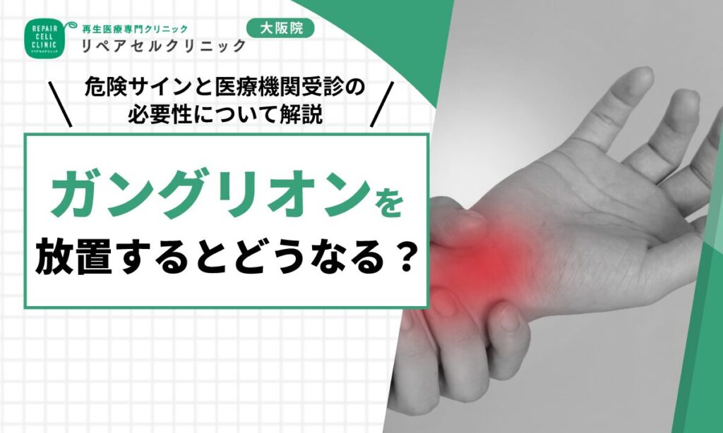 ガングリオンを放置するとどうなる？危険サインと医療機関受診の必要性について解説