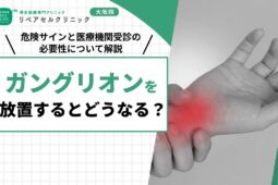 ガングリオンを放置するとどうなる？危険サインと医療機関受診の必要性について解説