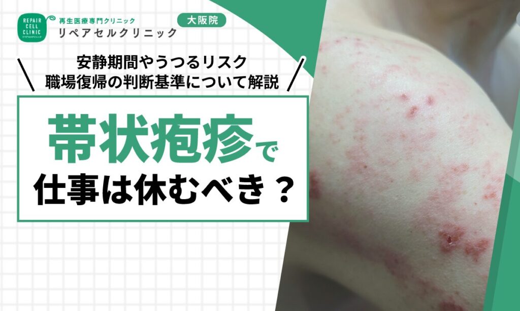 帯状疱疹で仕事は休むべき？安静期間やうつるリスク、職場復帰の判断基準について解説
