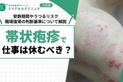 帯状疱疹で仕事は休むべき？安静期間やうつるリスク、職場復帰の判断基準について解説