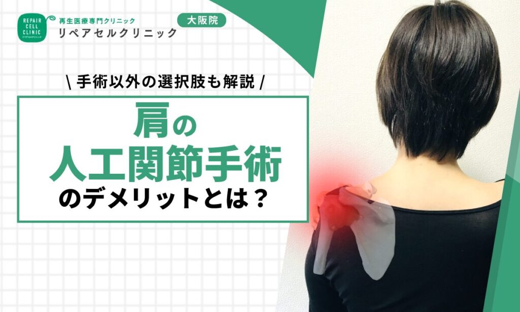 肩の人工関節手術のデメリットとは？手術以外の選択肢も解説