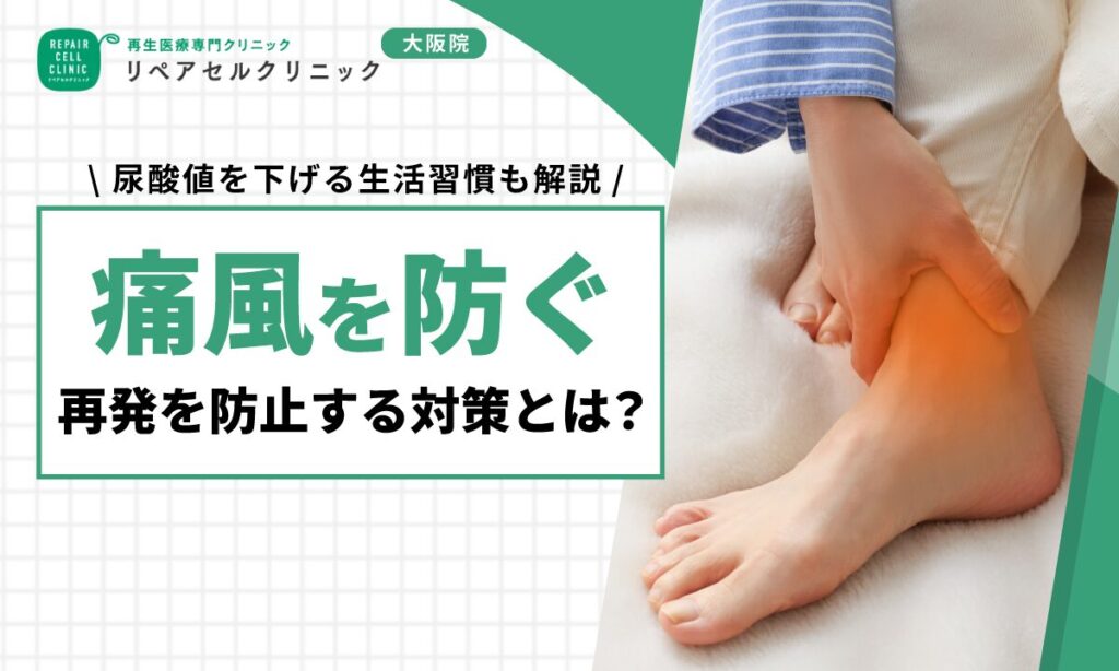 痛風を防ぐ・再発を防止する対策とは？尿酸値を下げる生活習慣も解説