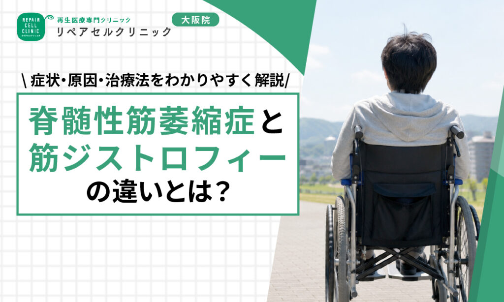 icatch 01