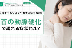 icatch 02