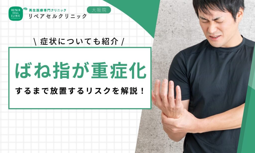 ばね指が重症化するまで放置するリスクを解説！症状についても紹介