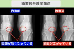 O1154 knee 2026