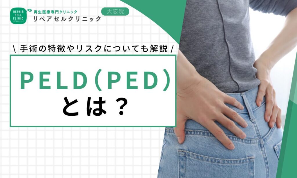 PELD（PED）とは？手術の特徴やリスクについても解説