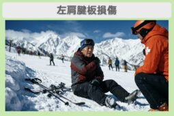 左肩腱板損傷のイメージ