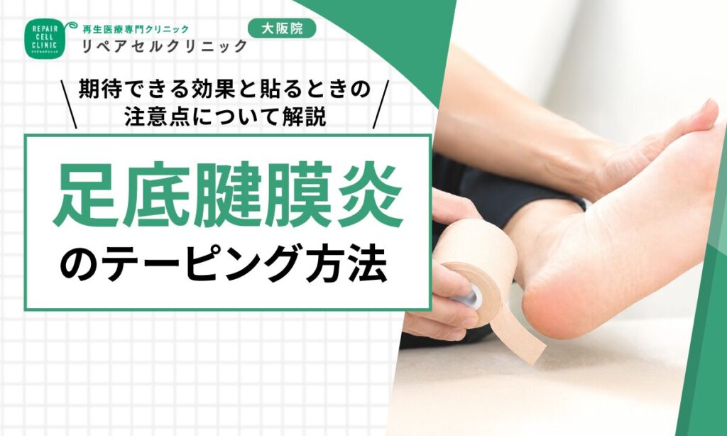 足底腱膜炎のテーピング方法｜期待できる効果と貼るときの注意点について解説
