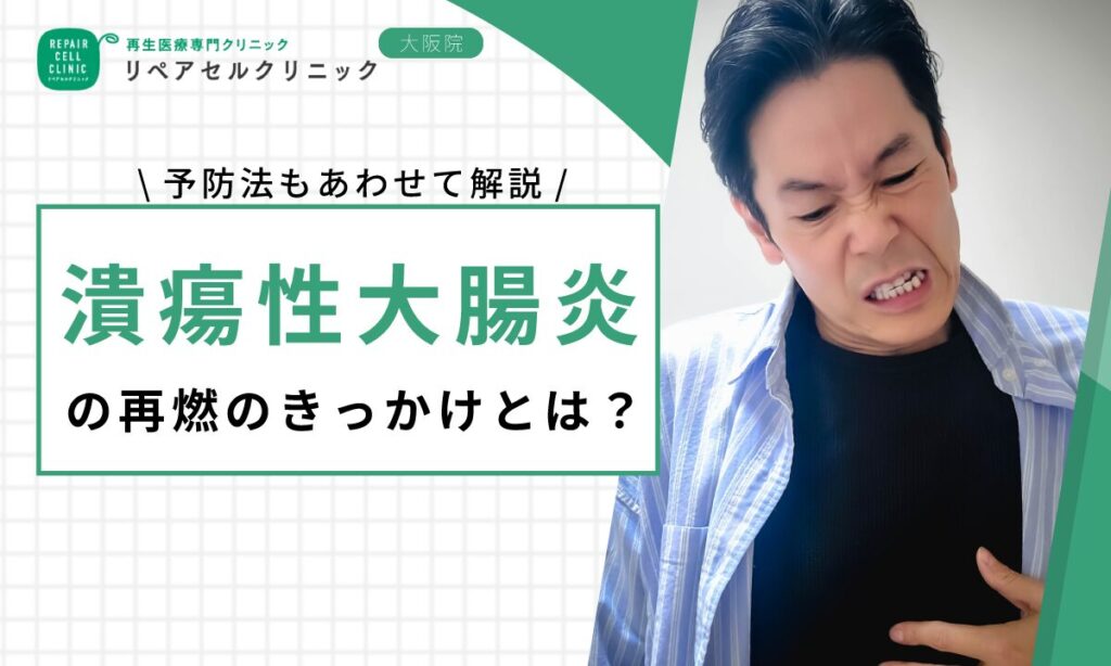 潰瘍性大腸炎の再燃のきっかけとは？予防法もあわせて解説
