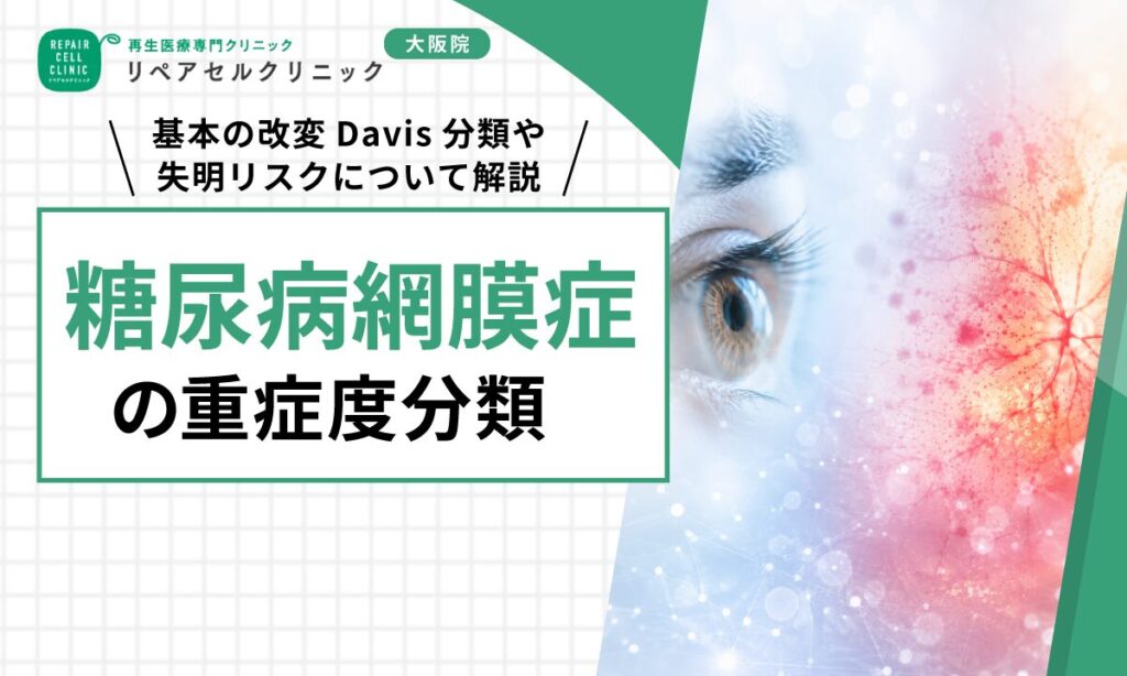 糖尿病網膜症の重症度分類｜基本の改変Davis分類や失明リスクについて解説