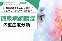 ブレインフォグの治療法とは｜主な症状や原因・有効なセルフケアについて解説