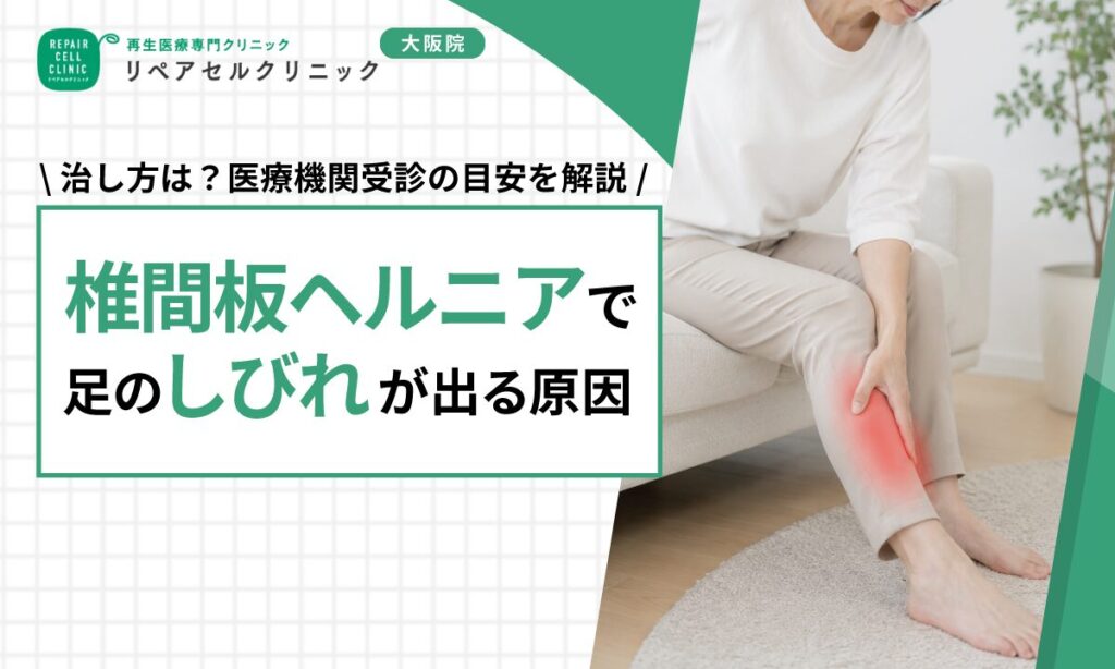 椎間板ヘルニアで足のしびれが出る原因｜治し方は？医療機関受診の目安を解説