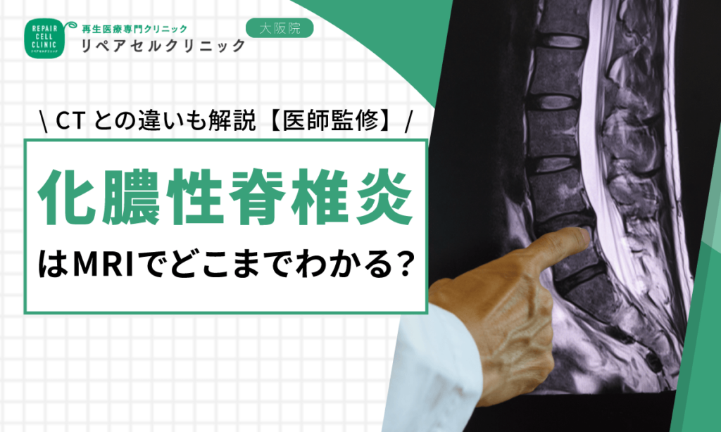 化膿性脊椎炎はMRIでどこまでわかる?CTとの違いも解説【医師監修】