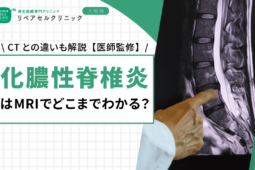 化膿性脊椎炎はMRIでどこまでわかる？CTとの違いも解説【医師監修】