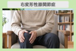 右変形性膝関節症 60代男性のイメージ（AI生成・患者本人ではありません）