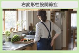 右変形性股関節症 40代女性のイメージ（AI生成・患者本人ではありません）